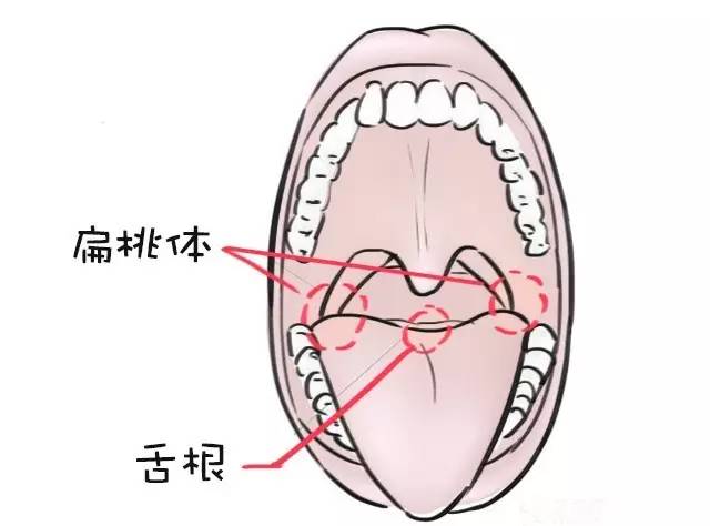 小伴身边的故事:一根700元的鱼刺