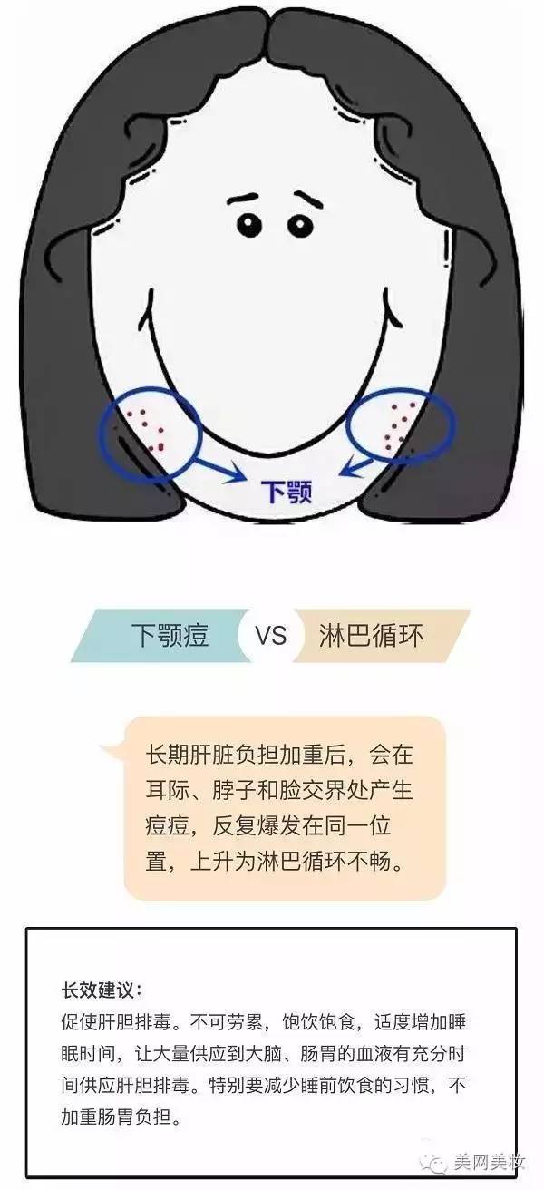 长痘痘的位置图解找病因 轻松应对不烦心