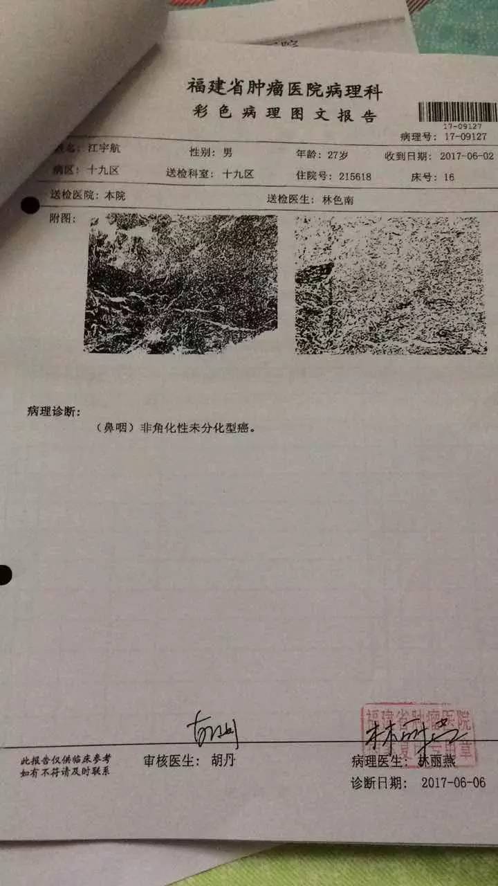 第七次人口晋查长表_第七次人口普查长表(2)