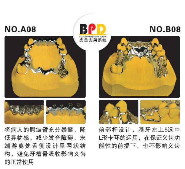 口腔可摘局部义齿支架设计大全