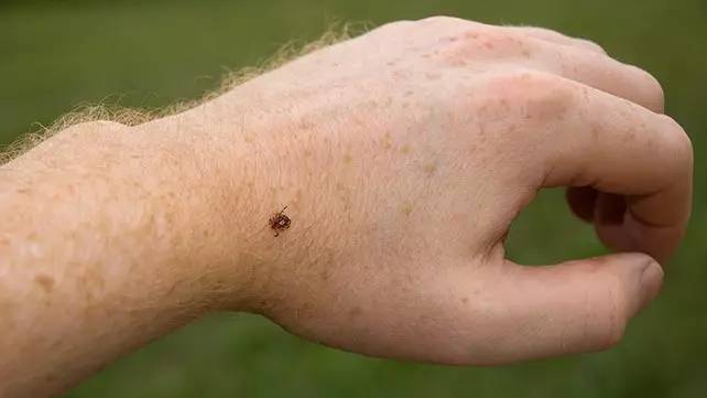 纽约州疾控中心警告:夏季蜱虫大规模活跃