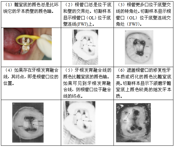 ③根管口位置现象 2:根管口通常位于髓室底与髓壁的交接线的拐角处.