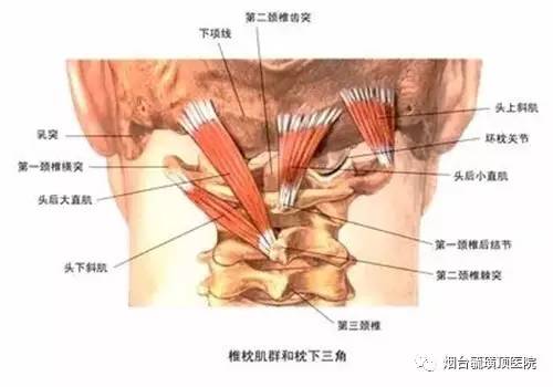 引发头痛的枕三角,是指枕骨下,包括颈后第一颈椎和第二颈椎的范围.