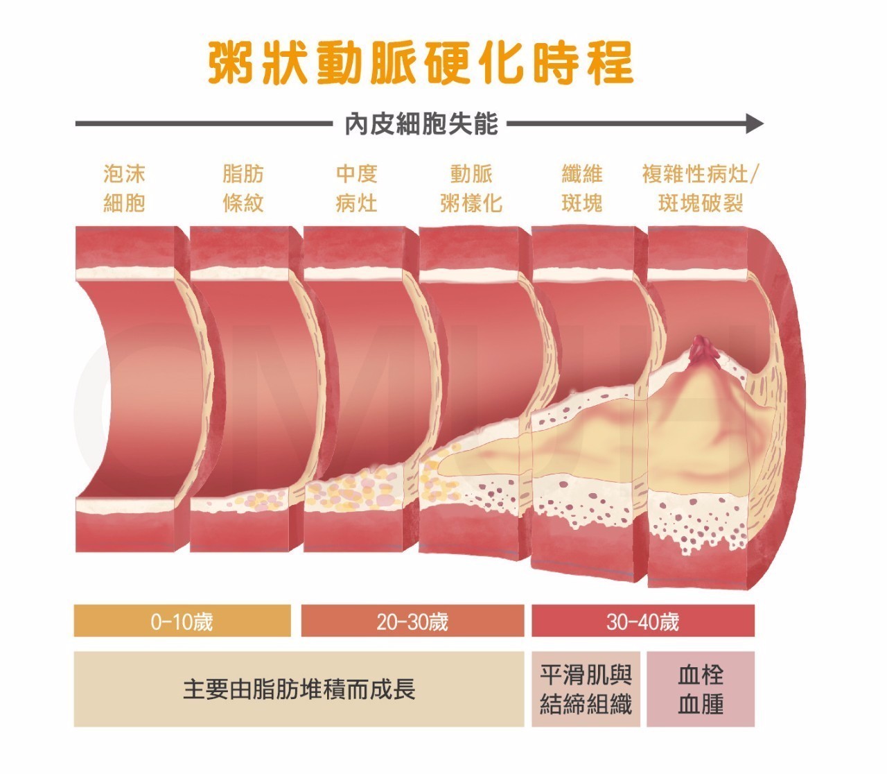 由于动脉硬化的形成过程相当缓慢,多数病人最初没有明显的自觉症状