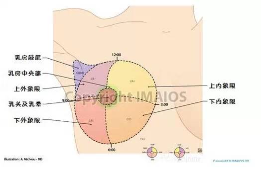 临床上以乳头为原点,画横纵轴将乳房分为四个象限,外上象限乳腺癌原发