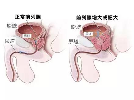 里急后重、肛门坠胀或与肛肠疾病无关