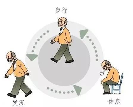 "间歇性跛行".