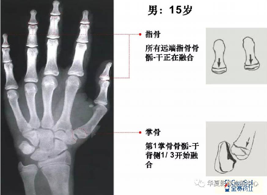 有了这张骨龄图,轻松了解孩子的成长情况!