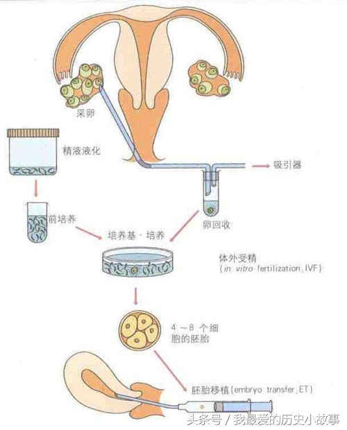 一组照片记录试管婴儿孕育全过程