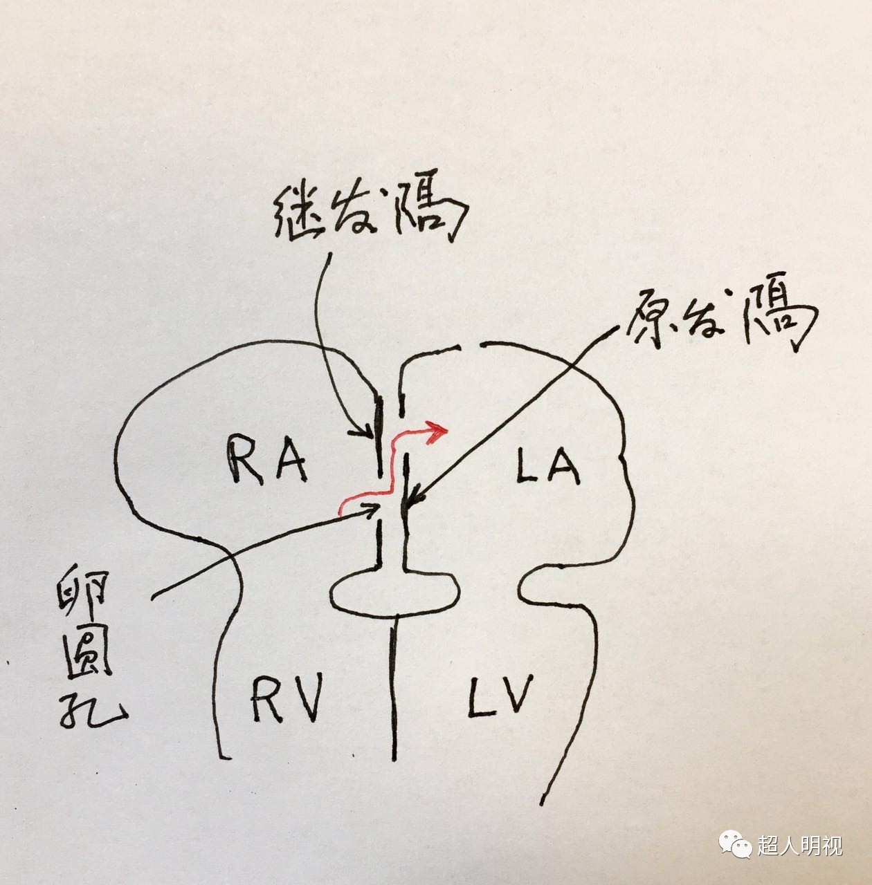 看英文，了解房间隔形成