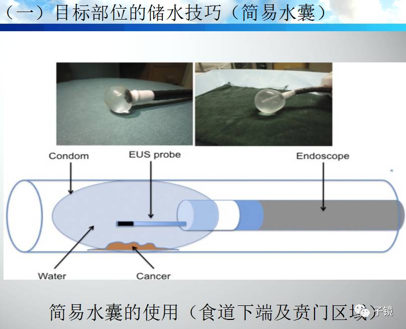 胡端敏教授"超声小探头的扫描技巧"讲座学习笔记