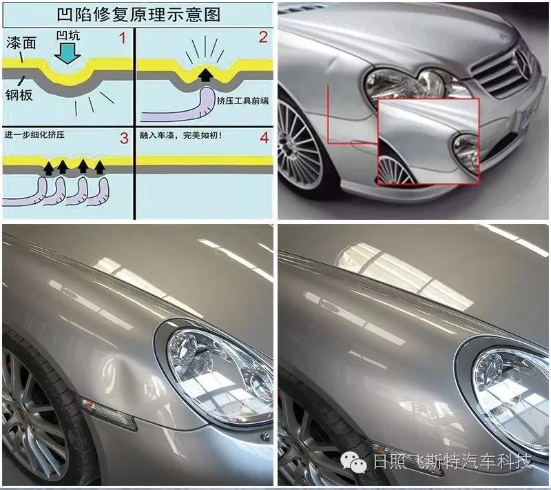 汽车免喷漆凹陷修复技术无须钣金喷漆保留原车漆面飞斯特汽车后市场