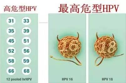 HPV是什么鬼?人乳头瘤病毒,可不是长在乳房上