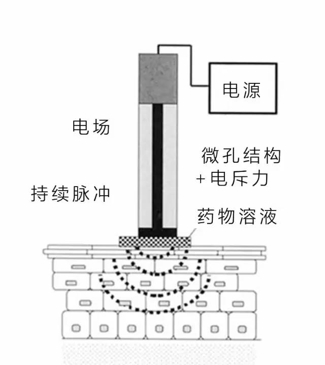 负压去除老化角质 使肌肤光滑透亮 「电穿孔疗法」 是利用微电流刺激