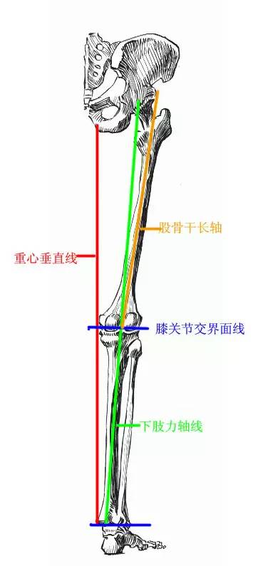 起点:髂骨前棘突下侧,股骨大转子骨斗附近.