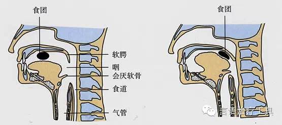 当喉头前移时,食道上端张开,食物被挤入食道,继而引起食道蠕动,即食