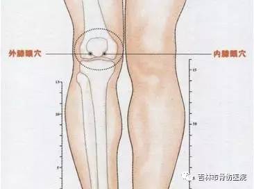 补肾活血方治疗膝关节骨关节炎60例临床研究