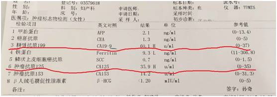 32 岁,我和卵巢癌擦肩而过,这才知道,女性离妇科肿瘤