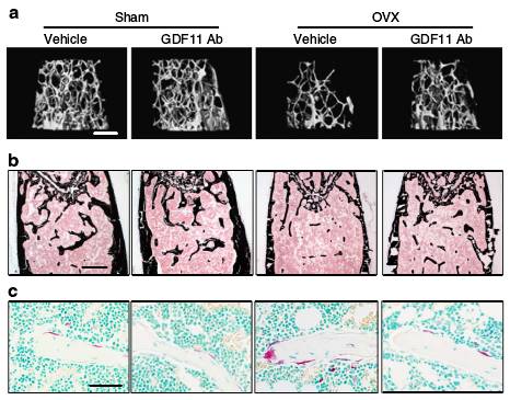 gdf11通过激活破骨细胞发生和抑制成骨细胞分化来降低骨量文献精读