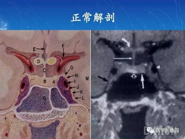 蝶鞍区域病变影像诊断与分析策略| 影像天地