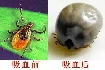 被吸血虫咬了怎么办