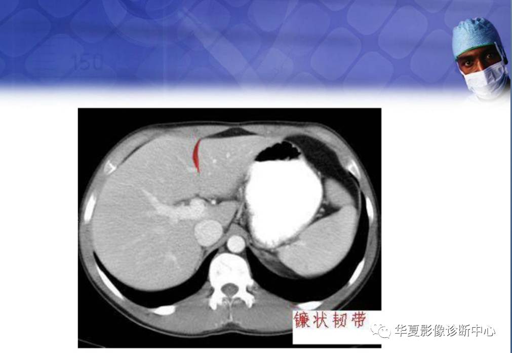 ct在上消化道穿孔中的应用