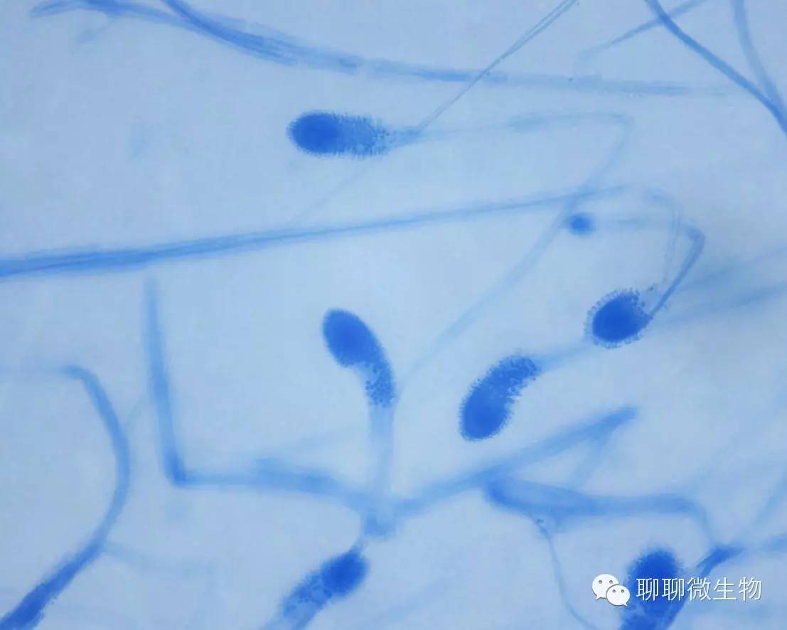 如何在显微镜下观察霉菌？ - 知乎