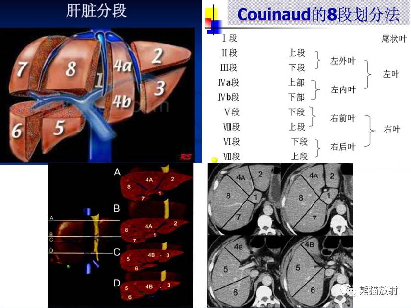 解剖上腹部ct断层双语肝脏解剖及肝段分布腹部淋巴结分布