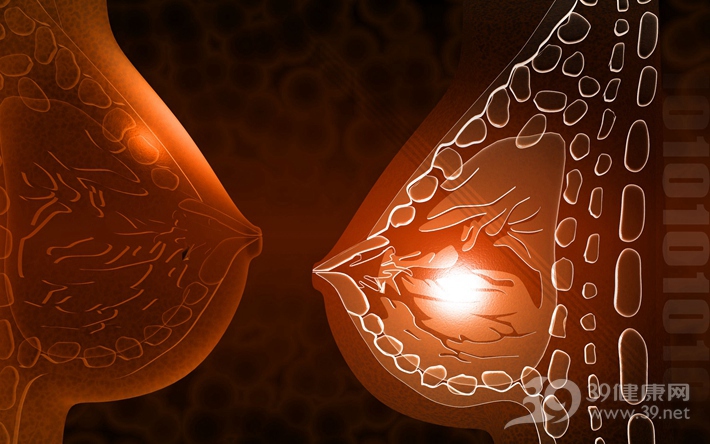 这5个症状是乳腺癌前兆!遇上一定不能忽视
