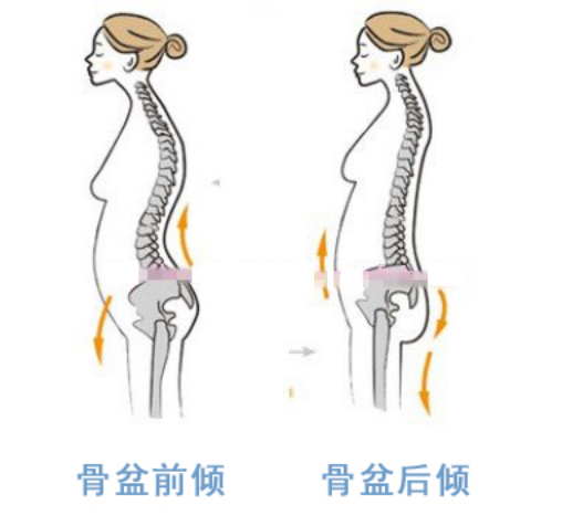 为什么你的站姿不挺拔有没有听过骨盆前倾