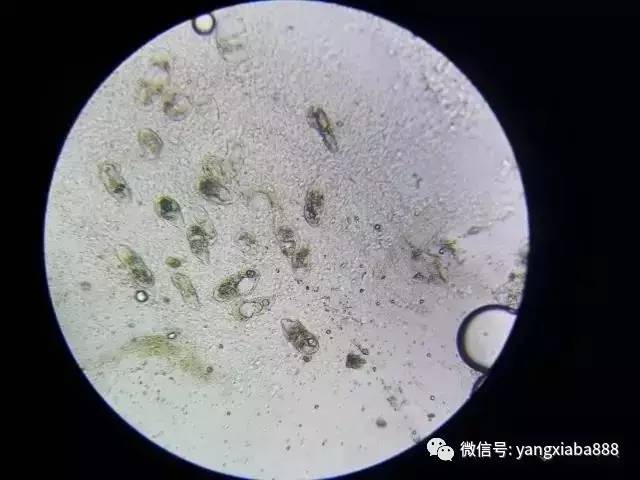 显微镜下的寄生虫和蓝藻,你知道多少?