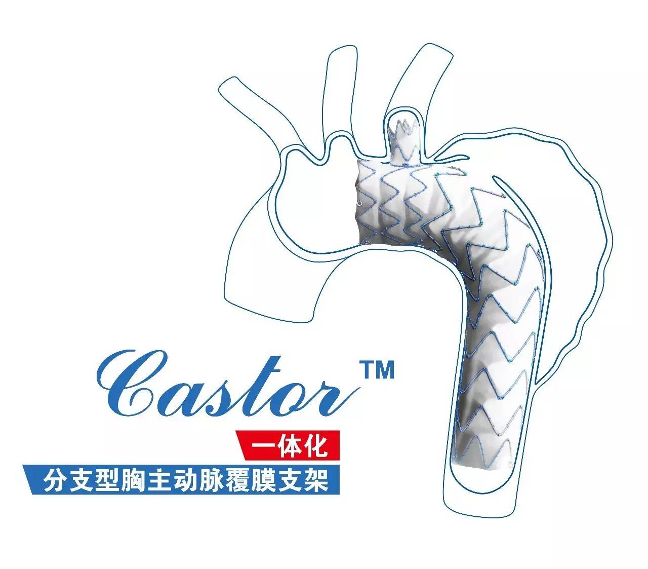 突破性进展 | 先健胸腹主动脉覆膜支架系统中国注册临床试验（GUARANTEE study）首例入组圆满成功！