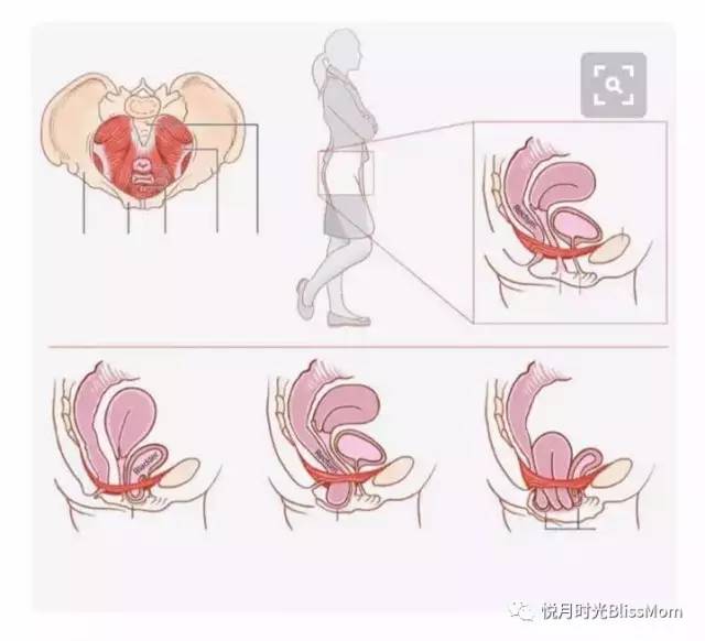 正常的盆底肌如图1-3,盆底肌像一个网兜,将直肠,子宫和膀胱都稳稳兜