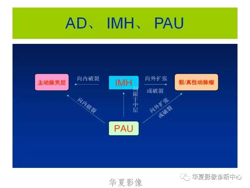 主动脉夹层、壁间血肿及穿透性溃疡形成