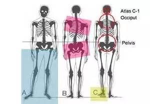 骨盆人口右倾斜经_骨盆倾斜图片(3)