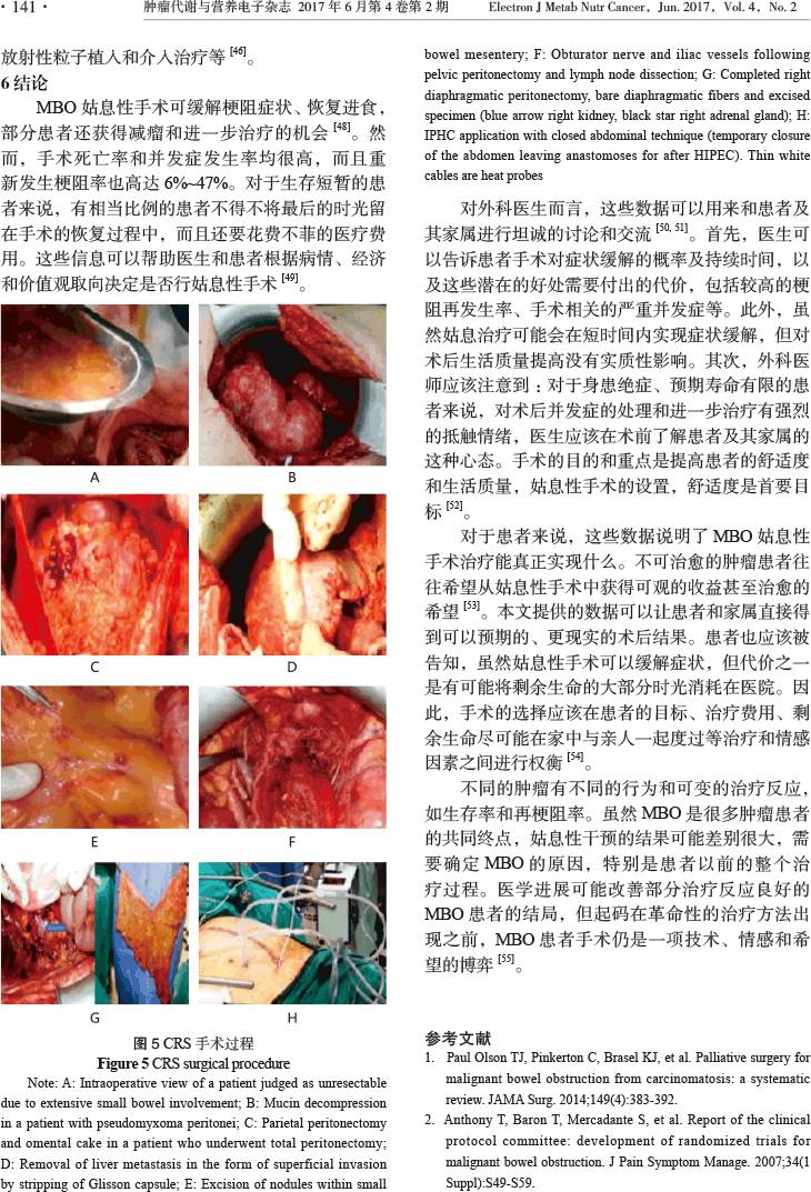 癌性肠梗阻:技术,情感和希望的博弈