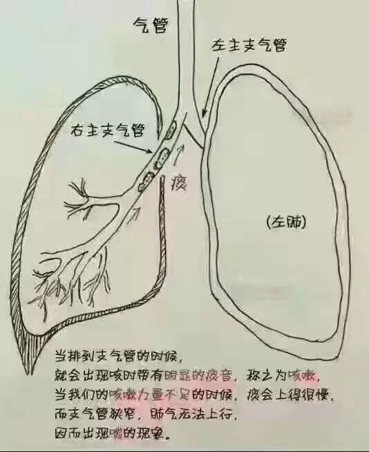 痰的原理是什么_肺癌的血痰是什么颜色