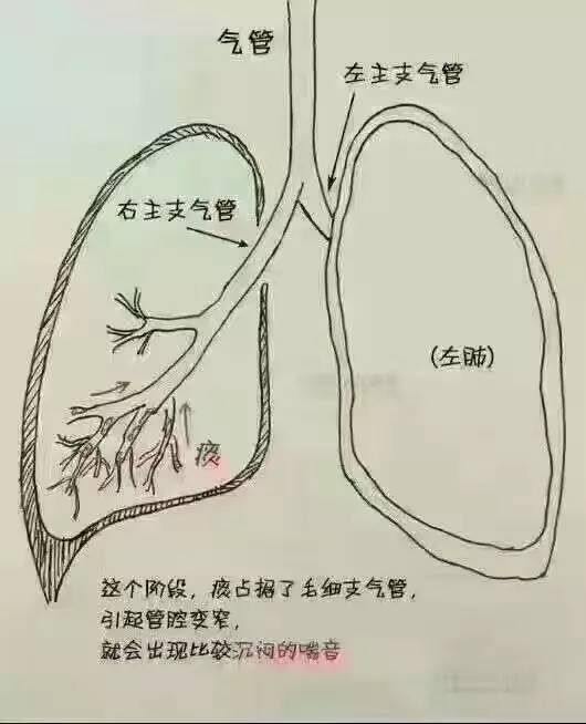 痰的原理是什么_肺癌的血痰是什么颜色