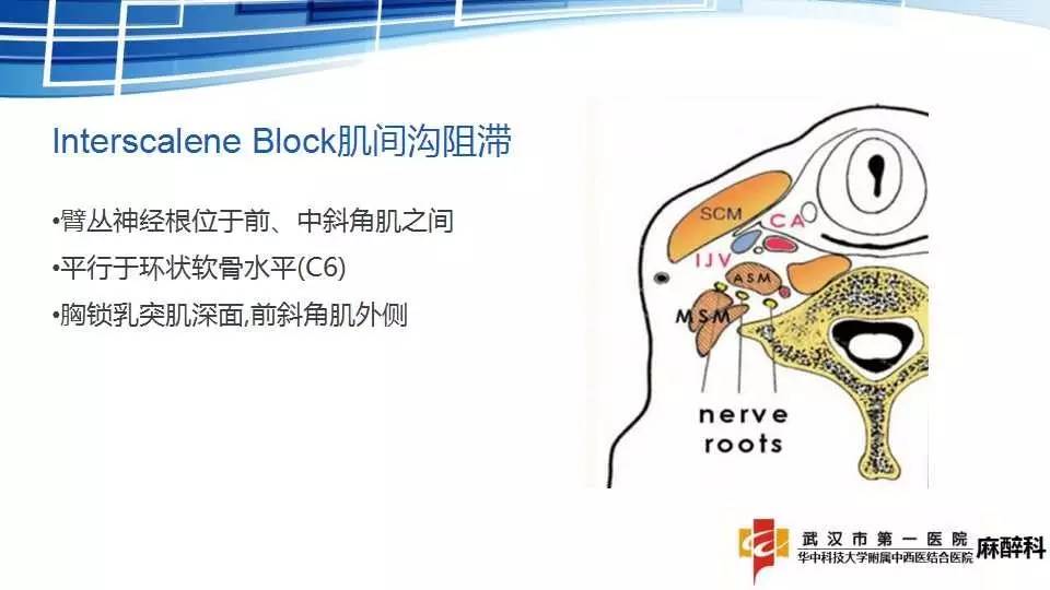 麻醉讲堂臂丛神经阻滞