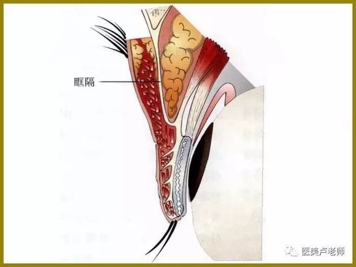 眶隔与眶隔脂肪