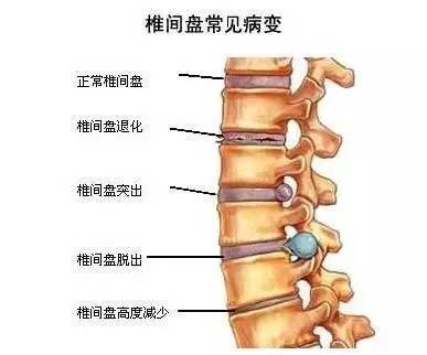 手术就是里面锁了两螺丝那种过了20天身上骨