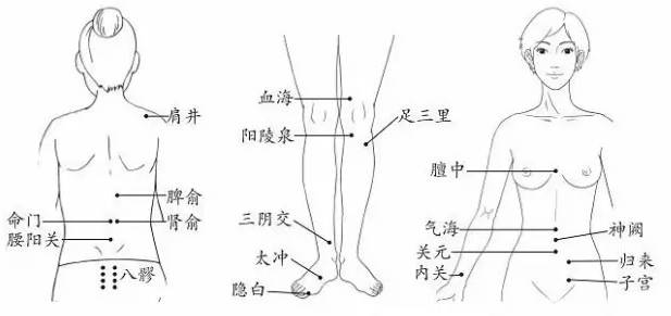 拔火罐的原理和作用_拔火罐减肥的原理是什么 拔火罐减肥有哪些注意事项(2)