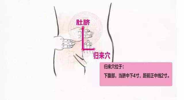 配穴:中极,归来(位于人体的下腹部,当脐中下4寸,距前正中线2寸),八髎