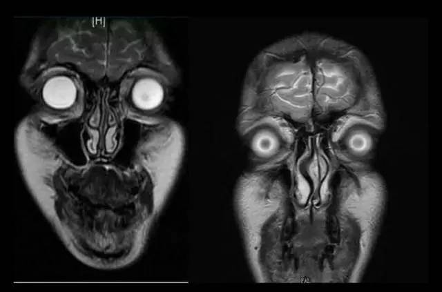 mri (核磁共振摄影) 是一个很厉害的医疗技术,运用rf射频波激发人体