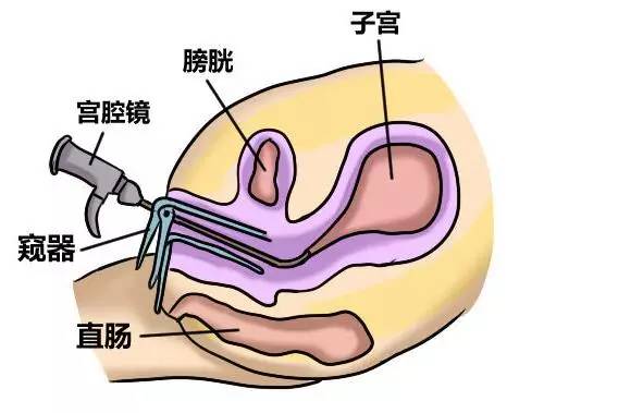 【妇产yesno】蒋国庆医生:子宫疾病知多少?你了解几个