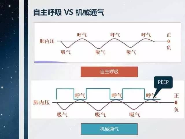 潮式呼吸发生的原理是什么_什么是腹式呼吸图解