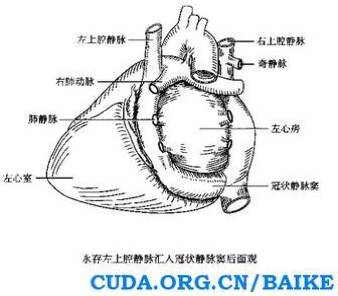 孕妈妈注意了胎儿永存左上腔静脉是严重畸形不能要吗