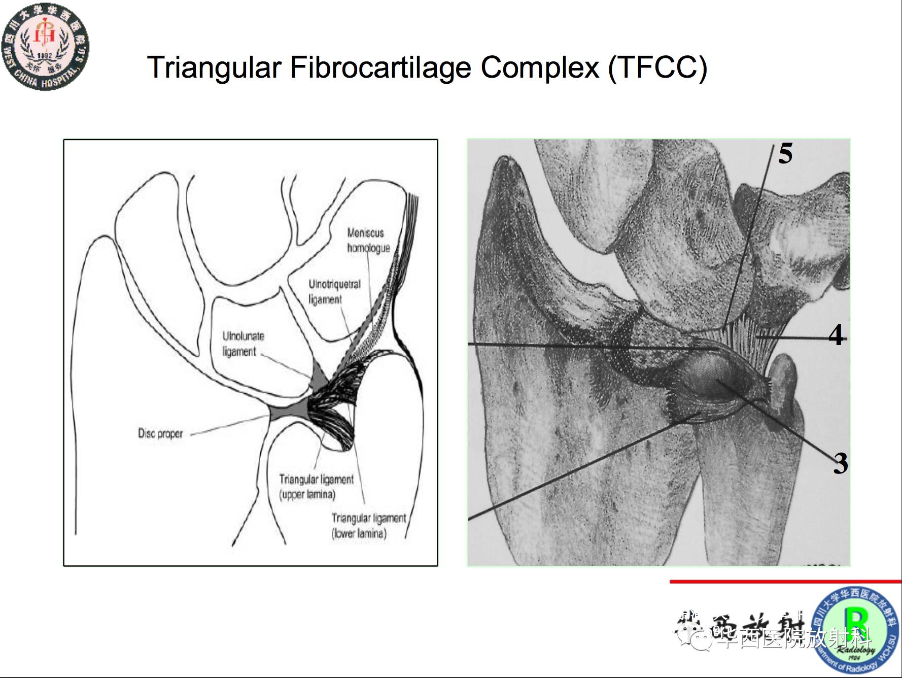 华西放射科深度业务学习系列之二十三—指间关节和三角纤维软骨复合