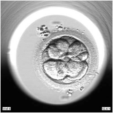 胚胎的体外72变