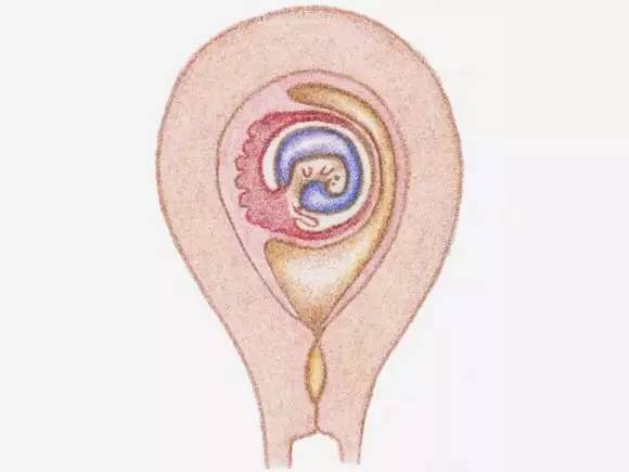 形成胚胎,并从输卵管往子宫缓缓移动,7天后,胚胎会到达子宫,开始着床